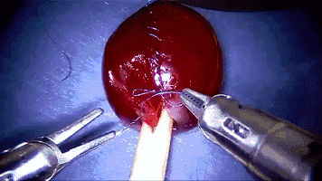 1594102192127542.gif https://mmbiz.qpic.cn/mmbiz_gif/LJiau2qPWAcUxpQbwYotc2mvZ6Es0uyepJLzolfxEHvxzoLATKaGyvuHfSOPu57IZSpUYxE58a6TsmDuI6HgVLw/640?wx_fmt=gif&wxfrom=5&wx_lazy=1